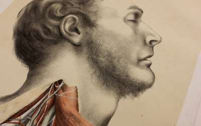 Antique Throat Dissection Lithograph